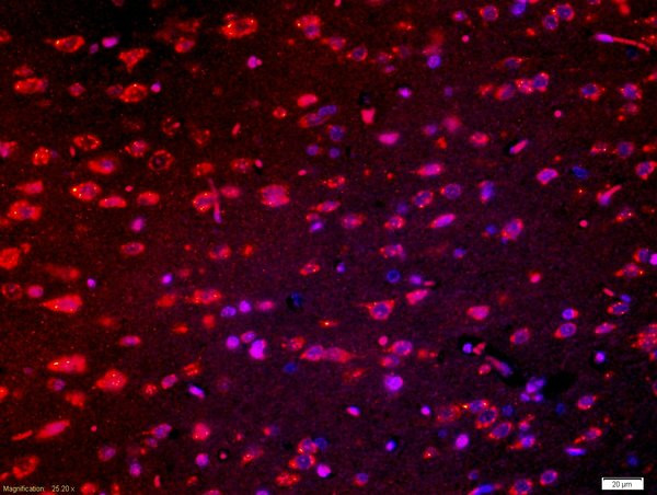 Robo1/2 Antibody in Immunohistochemistry (Paraffin) (IHC (P))