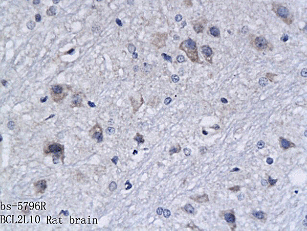 BCL2L10 Antibody in Immunohistochemistry (Paraffin) (IHC (P))