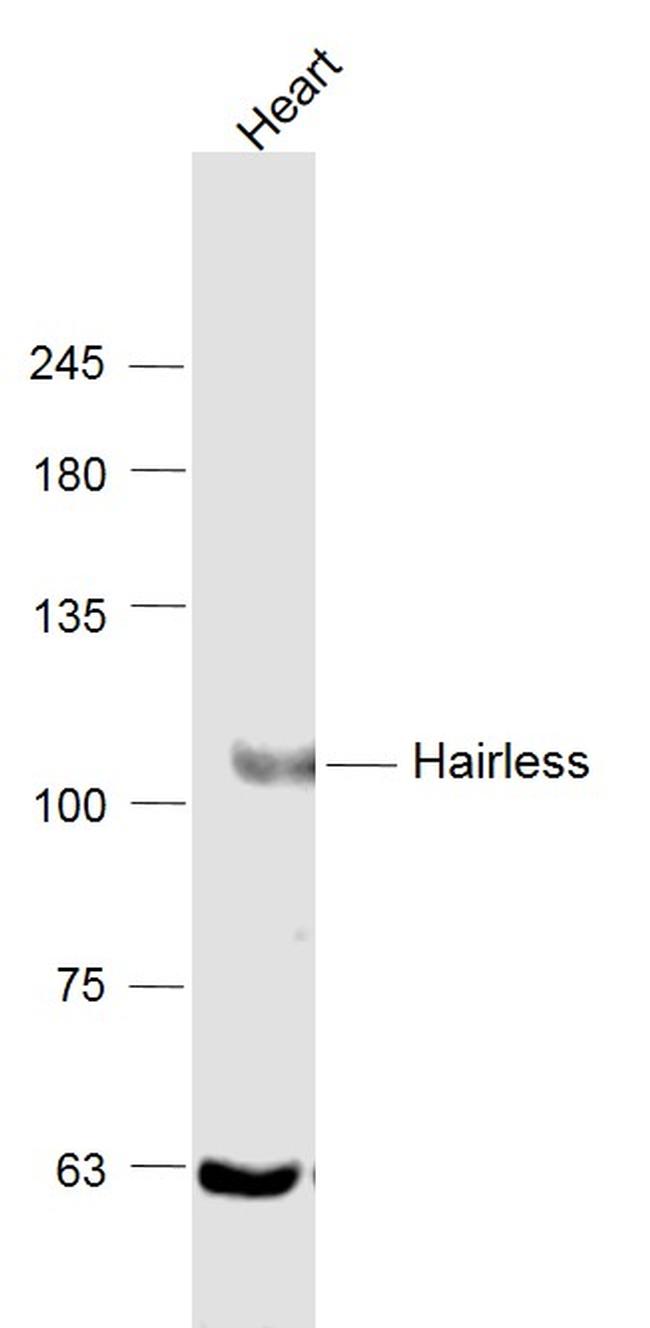 USP28 Antibody in Western Blot (WB)