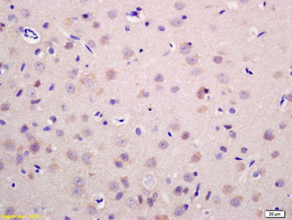 RAB21 Antibody in Immunohistochemistry (Paraffin) (IHC (P))