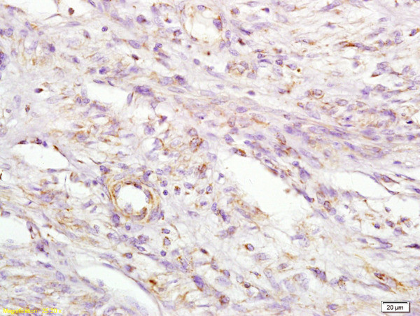 MIIP Antibody in Immunohistochemistry (Paraffin) (IHC (P))