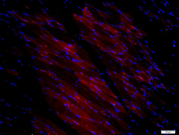 CDCP1 Antibody in Immunohistochemistry (Paraffin) (IHC (P))
