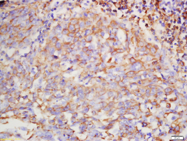 Hyaluronidase2 Antibody in Immunohistochemistry (Paraffin) (IHC (P))