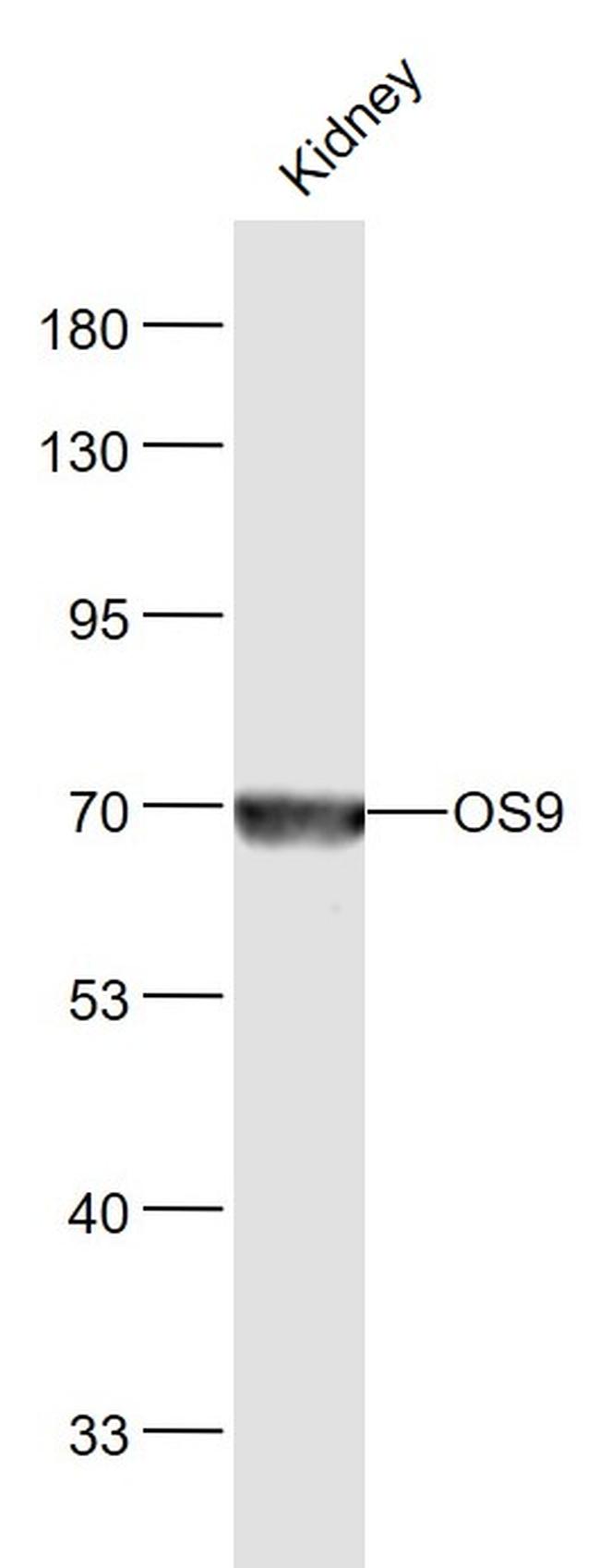 OS9 Antibody in Western Blot (WB)