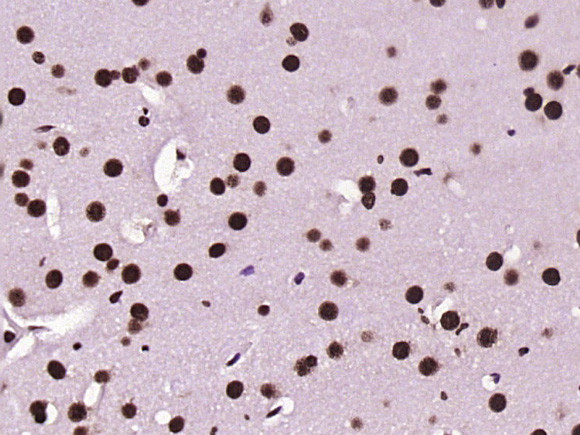 KLHL7 Antibody in Immunohistochemistry (Paraffin) (IHC (P))