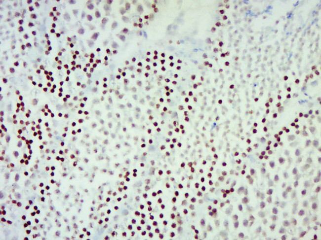 RAD54B Antibody in Immunohistochemistry (Paraffin) (IHC (P))