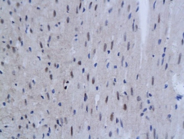 SnoN Antibody in Immunohistochemistry (Paraffin) (IHC (P))
