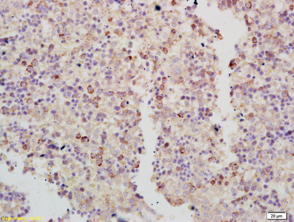 RASA3 Antibody in Immunohistochemistry (Paraffin) (IHC (P))