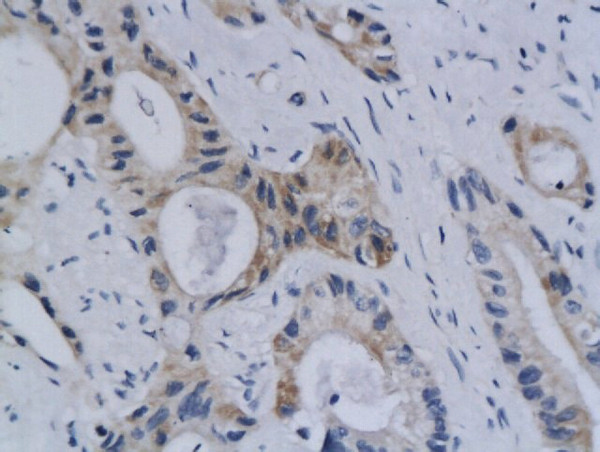 Styk1 Antibody in Immunohistochemistry (Paraffin) (IHC (P))