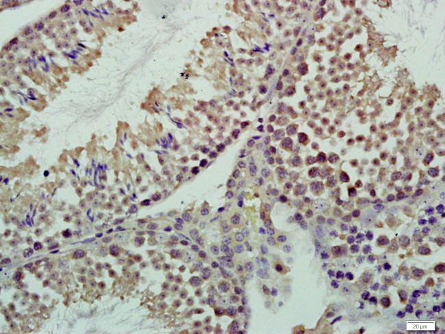 CASC5 Antibody in Immunohistochemistry (Paraffin) (IHC (P))