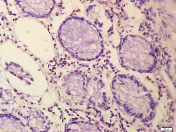 n-Myc Antibody in Immunohistochemistry (Paraffin) (IHC (P))