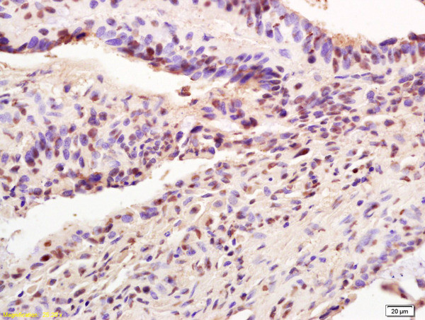 AIM2 Antibody in Immunohistochemistry (Paraffin) (IHC (P))