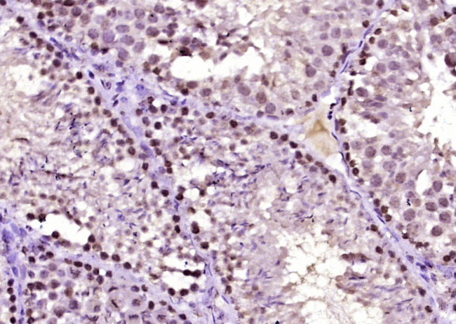 HSP40 homolog Antibody in Immunohistochemistry (Paraffin) (IHC (P))