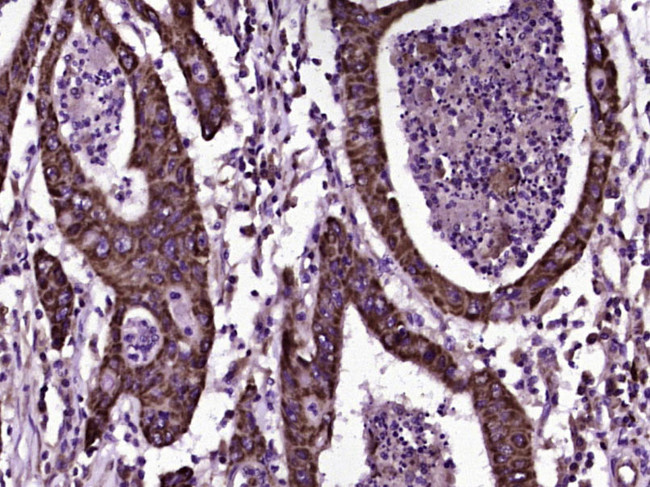 CD200 Antibody in Immunohistochemistry (Paraffin) (IHC (P))