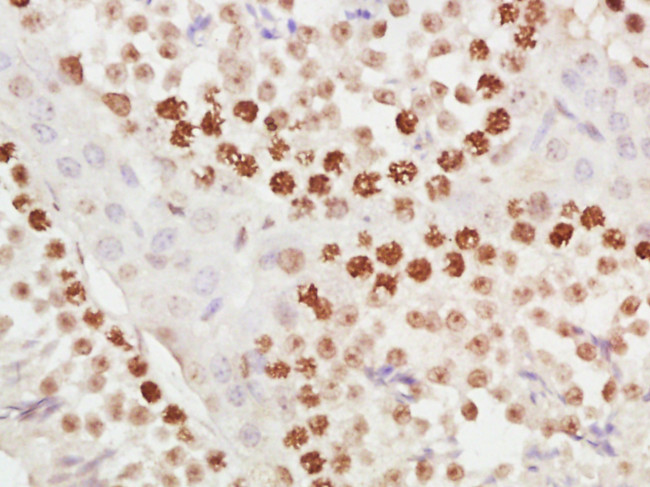 METTL11A Antibody in Immunohistochemistry (Paraffin) (IHC (P))