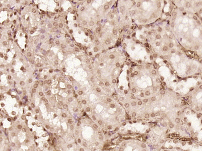 PRMT6 Antibody in Immunohistochemistry (Paraffin) (IHC (P))