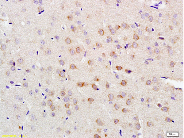 LLGL1 Antibody in Immunohistochemistry (Paraffin) (IHC (P))