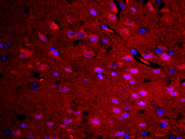 RASAL1 Antibody in Immunohistochemistry (Paraffin) (IHC (P))