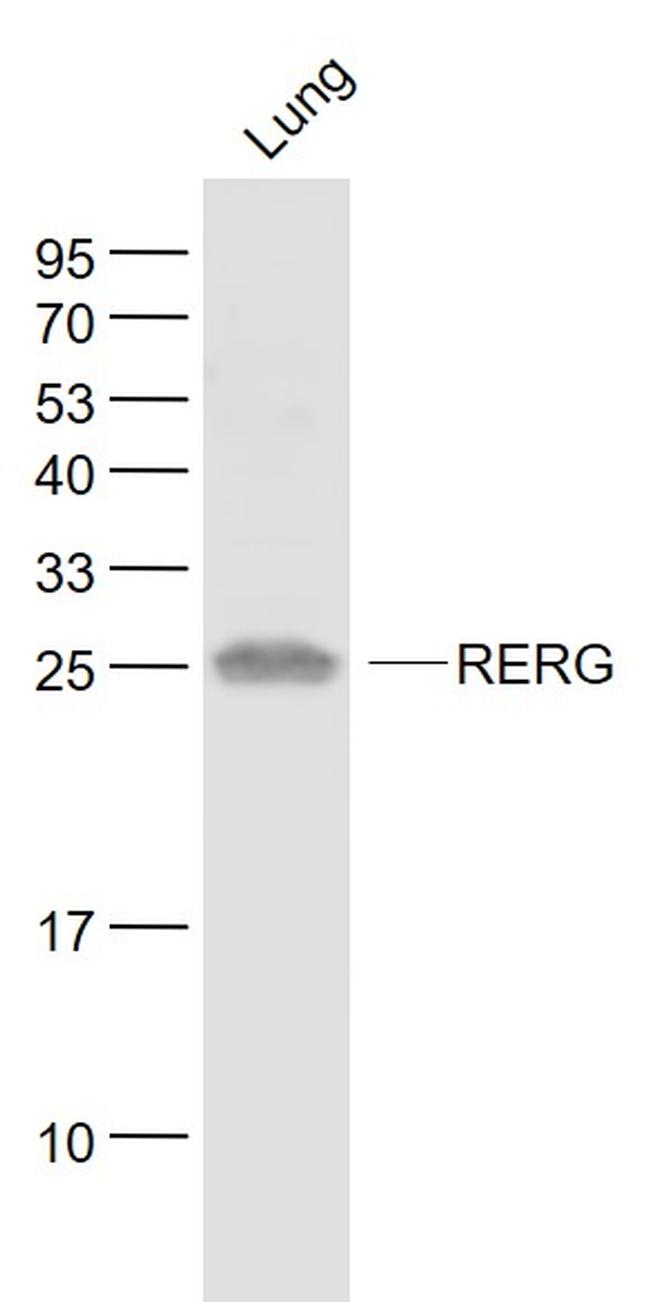 RERG Antibody in Western Blot (WB)