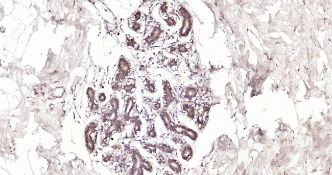 PDLIM4 Antibody in Immunohistochemistry (Paraffin) (IHC (P))