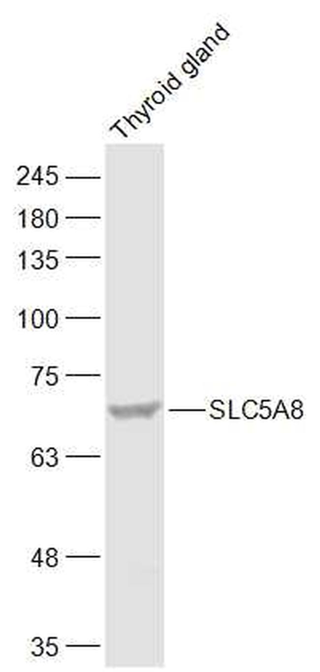 SLC5A8 Antibody in Western Blot (WB)