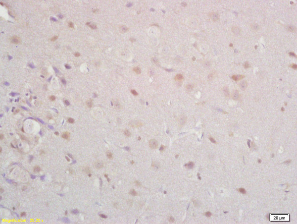 Tomoregulin-1 Antibody in Immunohistochemistry (Paraffin) (IHC (P))