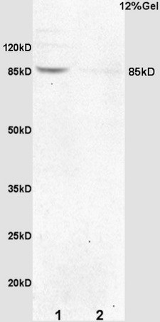 p95 NBS1 Antibody in Immunohistochemistry (Paraffin) (IHC (P))