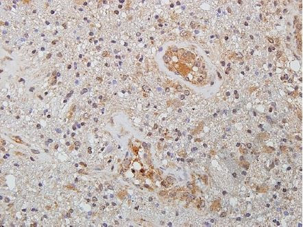WNT2 Antibody in Immunohistochemistry (Paraffin) (IHC (P))