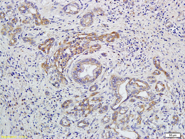 GNAQ Antibody in Immunohistochemistry (Paraffin) (IHC (P))