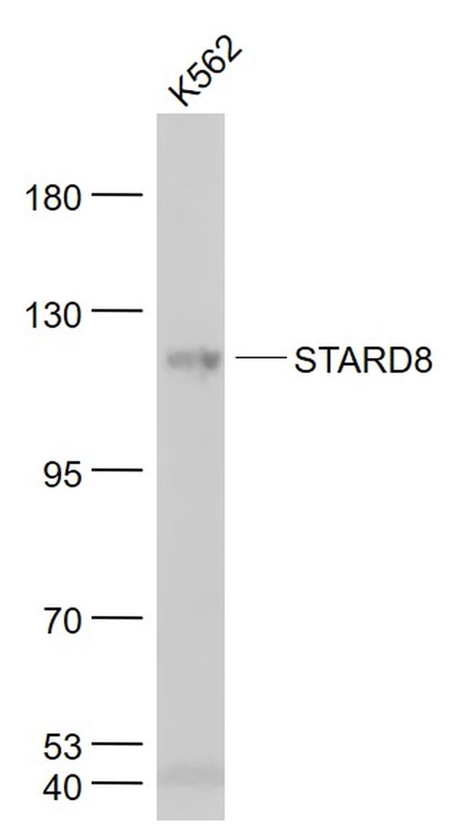 STARD8 Antibody in Western Blot (WB)