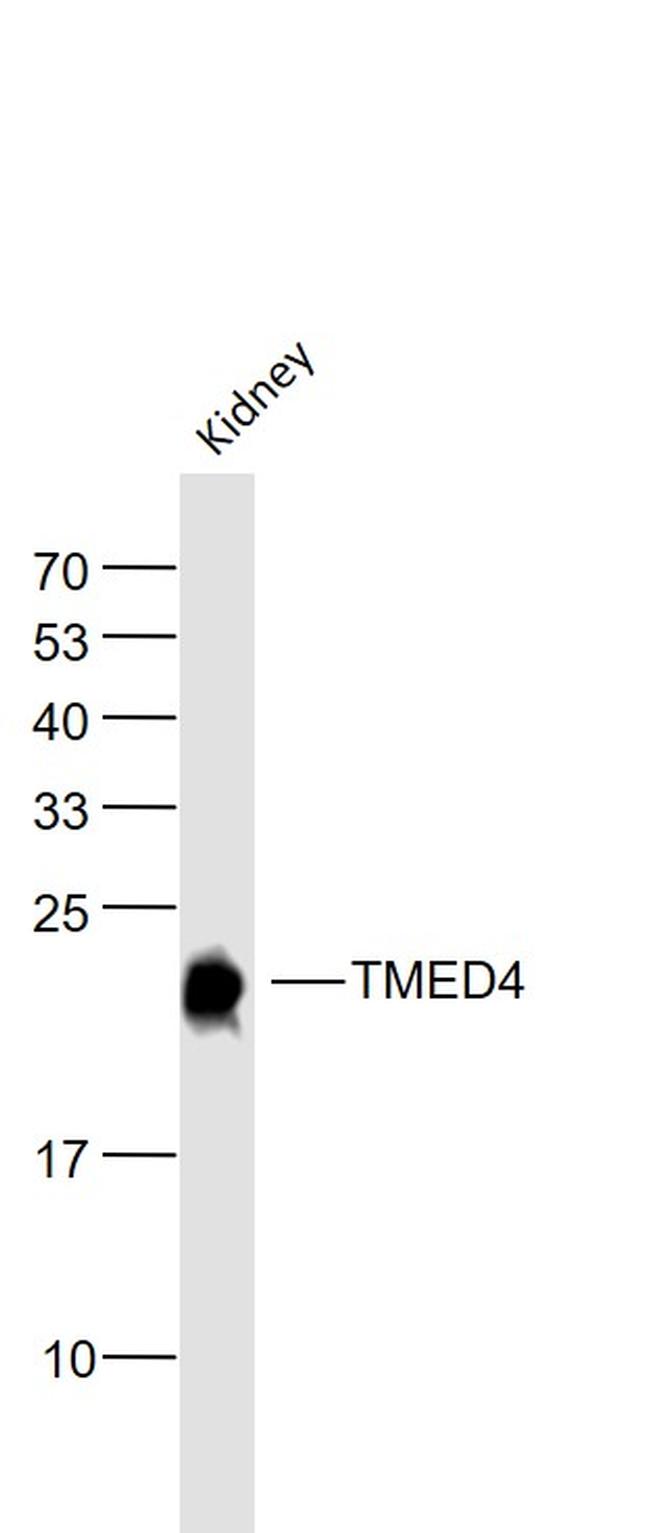 TMED4 Antibody in Western Blot (WB)