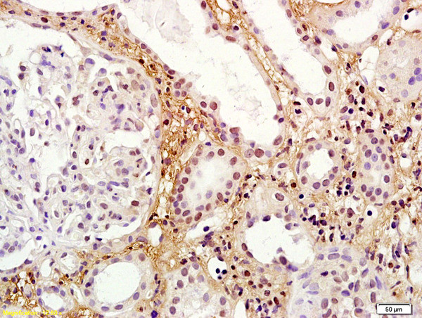 RORG Antibody in Immunohistochemistry (Paraffin) (IHC (P))