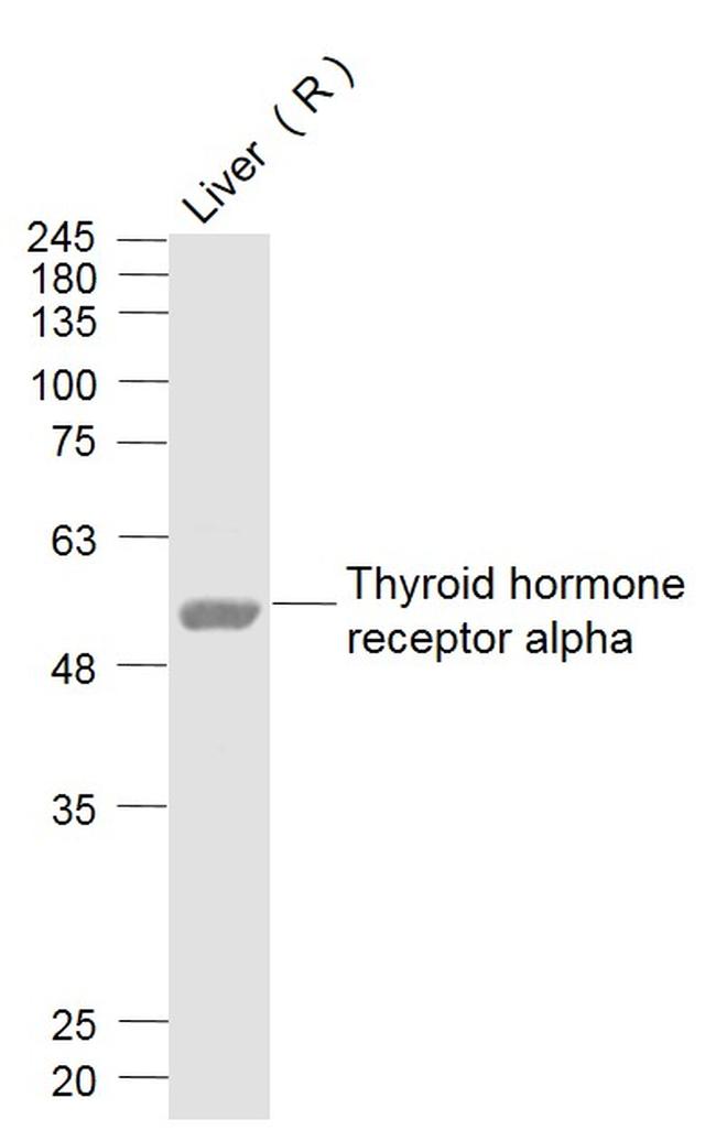 THRA1 Antibody in Western Blot (WB)