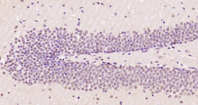 OTUB Antibody in Immunohistochemistry (Paraffin) (IHC (P))