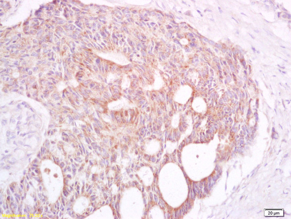 TAAL6 Antibody in Immunohistochemistry (Paraffin) (IHC (P))