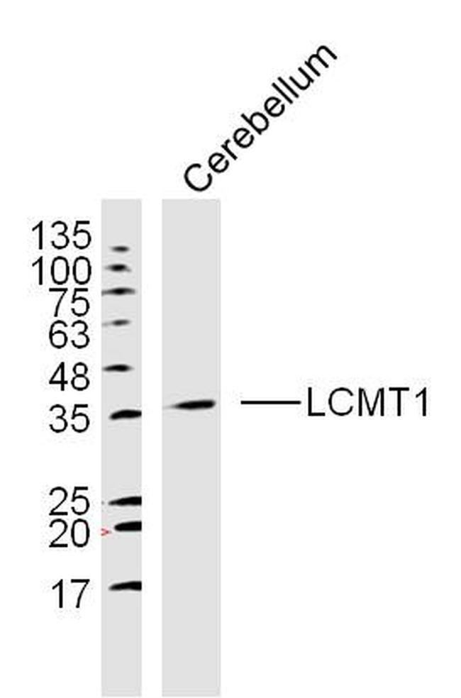 LCMT1 Antibody in Western Blot (WB)