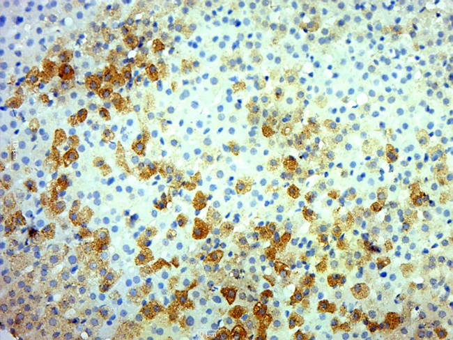 Ret Antibody in Immunohistochemistry (Paraffin) (IHC (P))