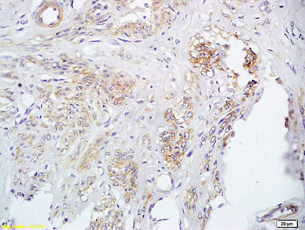 FUT8 Antibody in Immunohistochemistry (Paraffin) (IHC (P))