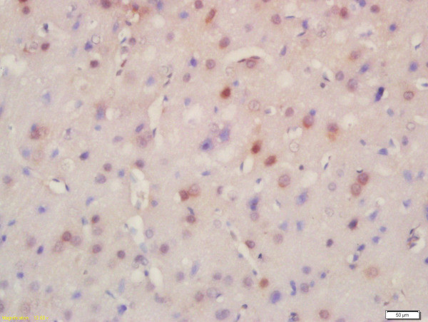 BRD8 Antibody in Immunohistochemistry (Paraffin) (IHC (P))