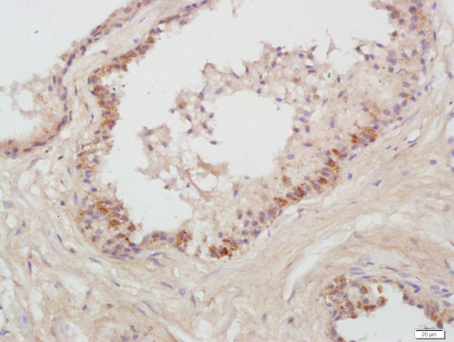 Prostatic Acid Phosphatase Antibody in Immunohistochemistry (Paraffin) (IHC (P))