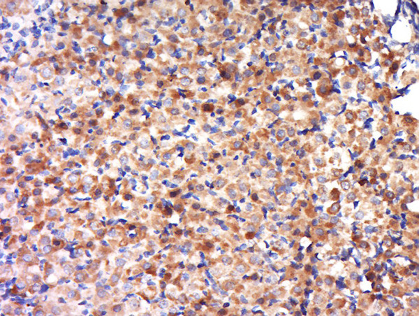 OVCA2 Antibody in Immunohistochemistry (Paraffin) (IHC (P))
