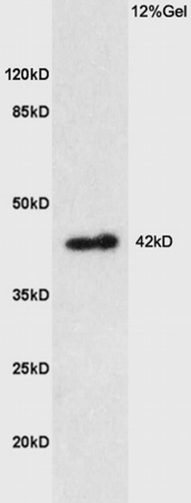 PTGER1 Antibody in Western Blot (WB)