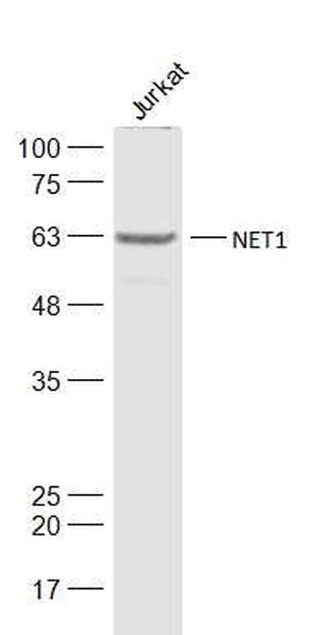 NET1 Antibody in Western Blot (WB)