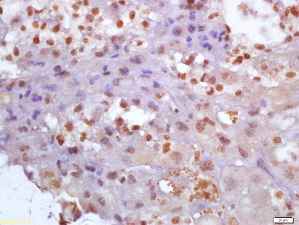 Glutamine PRPP amidotransferase Antibody in Immunohistochemistry (Paraffin) (IHC (P))