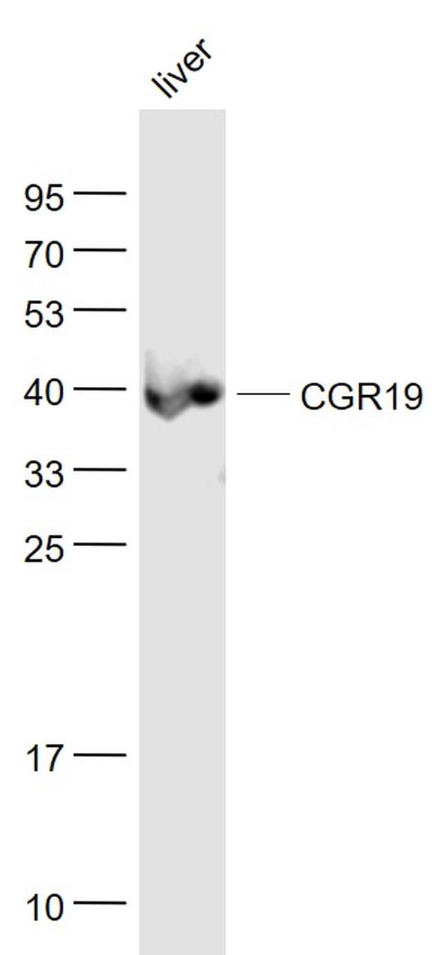 CGR19 Antibody in Western Blot (WB)