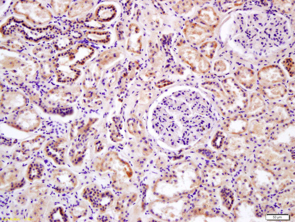 DDIT4L Antibody in Immunohistochemistry (Paraffin) (IHC (P))