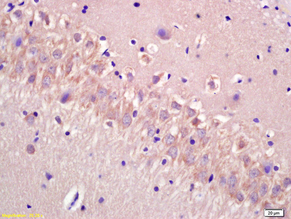 CECR5 Antibody in Immunohistochemistry (Paraffin) (IHC (P))
