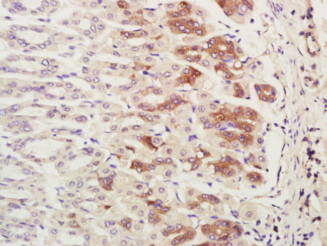 CHCHD2 Antibody in Immunohistochemistry (Paraffin) (IHC (P))