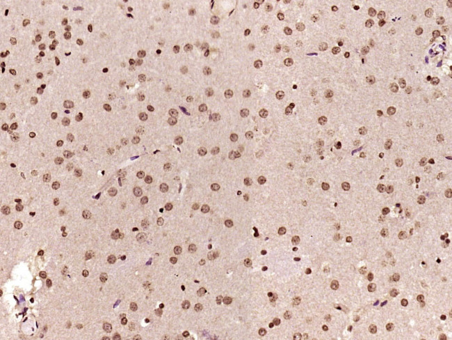 Phospho-PP2A alpha/beta (Tyr307) Antibody in Immunohistochemistry (Paraffin) (IHC (P))