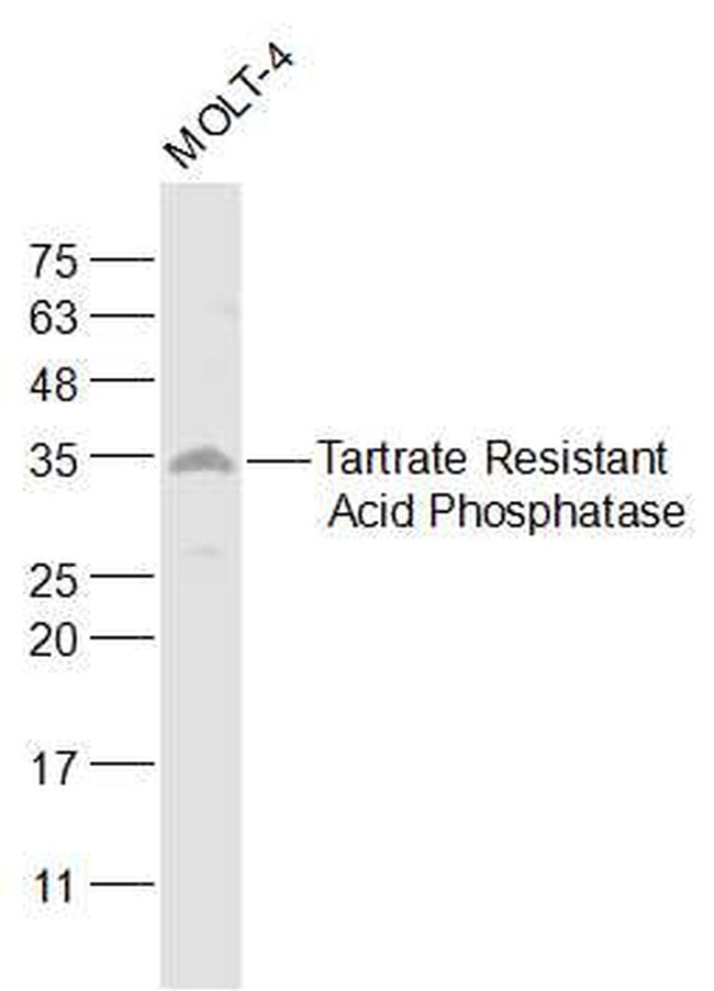 ACP5 Antibody in Western Blot (WB)